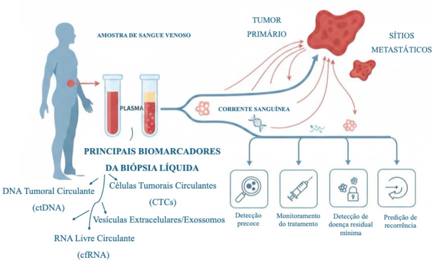Figura 1. Representação esquemática da biópsia líquida em oncologia. Componentes derivados do tumor, liberados a partir de lesões primárias e metastáticas, entram na corrente sanguínea e podem ser detectados em amostras de sangue periférico. Os principais biomarcadores incluem o DNA tumoral circulante (ctDNA), as células tumorais circulantes (CTCs), o RNA livre circulante (cfRNA) e as vesículas extracelulares. Esses analitos auxiliam na detecção precoce, no monitoramento terapêutico, na avaliação da doença residual mínima e na predição do risco de recorrência, evidenciando o papel da biópsia líquida como uma ferramenta complementar no manejo do câncer.